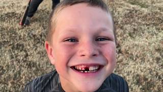 Knocked Some Teeth Out With a Baseball Bat! 365 Vlogs w/ Brett Cue - 068