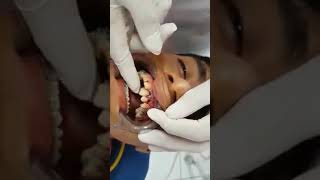 Dr Manuel Sanchez Laguna | Fractura Dental Alveolar