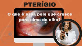 Tudo Sobre Pterígio!