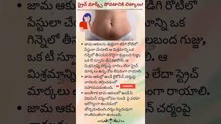 స్ట్రెచ్ మార్క్స్ పోవటానికి చిట్కాలు #stretchmarks #women #homeremedies #viral #trending #shortsfeed