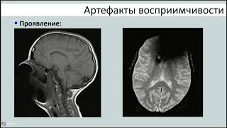 Артефакты и способы борьбы с ними