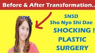 SNSD Im Yoona Plastic Surgery Before and After