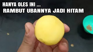 JANGAN ANGGAP ENTENG !! UBAN DIKEPALA HITAM SECARA PERMANEN