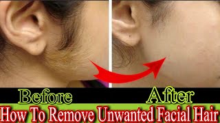 How to remove unwanted facial hair perminant|Facial hair removing