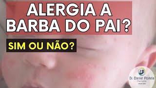 Alergia pele bebê e a BARBA do PAI: como saber? VÍDEO COMPLETO