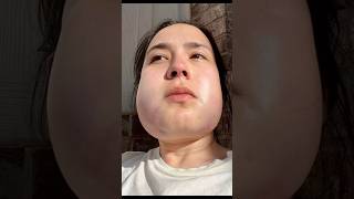 Wisdom Teeth WENT WRONG? Or? #wisdomteethremovalrecovery #wisdomtoothextraction #wisdomtoothremoval