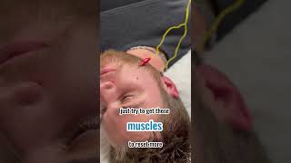 Muscle SPASMS in face from electrical stimulation