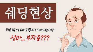 쉐딩현상이란? 탈모치료 부작용인가?