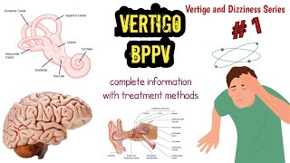 BPPV Treatment in Hindi | ear disease | Vertigo | Dizziness | BPPV exercise at home - 1