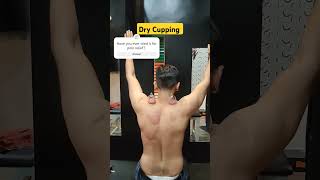 dry Cupping for pain relief #painmanagement #painrelief #physiotherapy #cupping #rehabilitation