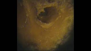 Temporal bone dissection (microscopic)GH byadagi-dr.shreekantha acharya