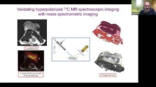 Stanford Radiology: CEDSS (Fall) 2022, Brindle: Imaging Tumor Metabolism – From Mouse to Man