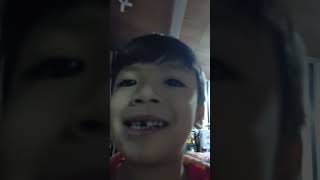 Ang Ngipin Kong Bungi #shorts  #funnyshorts #funnyvideo #funny #justforlaughs #justforfun