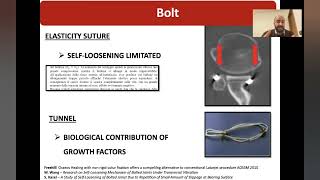 Arthroscopy-Guided Latarjet for Anterior Shoulder Instability