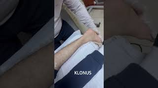 Klonus