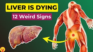 12 Weird Signs Of a DYING Liver | VisitJoy