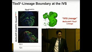 Genetics and Genomics for Congenital Heart Disease