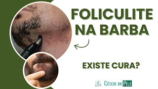 Foliculite na Barba: Causas e Tratamentos Específicos para Homens