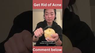 Natural Ways to Say Goodbye to Acne Scars | Diva Health 365 #shorts