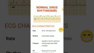 Normal Sinus Rhythm شرح باللغة العربية