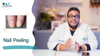 Dao Derma  | تقشير الاظافر