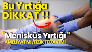 Menisküs Yırtığım Var ! Bamya Tohumu, Kollajen Destekleri, Kremler, Egzersiz İyileştirir mi ?