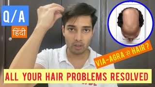 COMPLETE HAIR DISCUSSION| MINOXIDIL|FINASTERIDE|results|TRANSPLANT|Line|Hair|Fall|patch|Regrow|stop