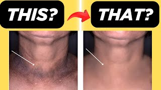 What Does This Skin Condition Mean? Cause and Treatment of DARK DISCOLORATION ON YOUR NECK AND BODY