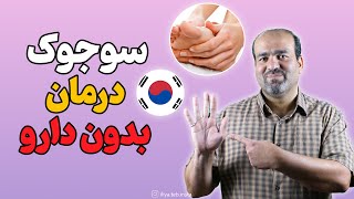 سوجوک، درمان بدون دارو