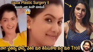 See How Samantha Face Before Plastic Surgery | Samantha Shocking Video Rare Video | Friday Culture