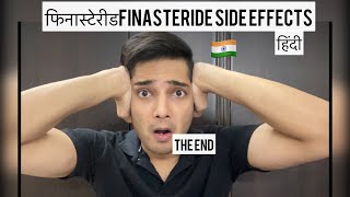 हिंदी Finasteride Side Effects| Finasteride Before and after| FINASTERIDE Results| Hairloss| Hindi