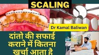 दातों की सफाई कराने में कितना खर्च आता है?||dental Scaling cost||Danto ki scaling ya Safai ka kharch