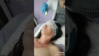 Alta Frecuencia facial