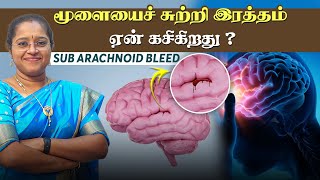 மூளையைச் சுற்றி இரத்தம் ஏன் கசிகிறது ?  SUB ARACHNOID BLEED | DR. A. VENI MD., DM., (NEURO)