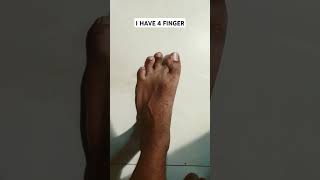 I have 4 fingers #shorts #fingers #funnyshorts