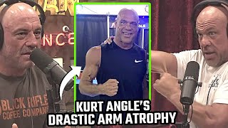 JRE: Kurt Angle Opens Up About His Multiple Neck Surgeries and Arm Atrophy