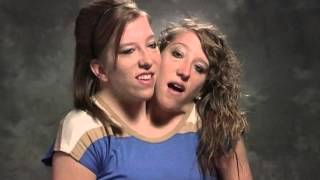 Conjoined Twins Abby And Brittany Hensel Get Own Reality Show