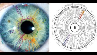 The Reproductive System as Seen in the Iris; Location of Organs & Sexuality Brain Zone