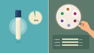 Detection of Fluconazole-Resistant Candida by Disk Diffusion Testing (Ann Lab Med)