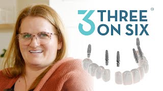 Implant Bridges to Restore Teeth with 3 on 6™ Treatment