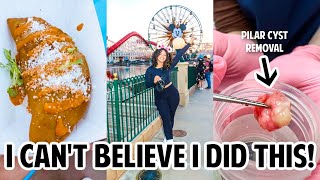 PILAR CYST REMOVAL EXPERIENCE, GOING TO DISNEYLAND + NEW JEWELRY