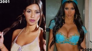 Kim Kardashian Before Surgery - Compare Now and Then Photos