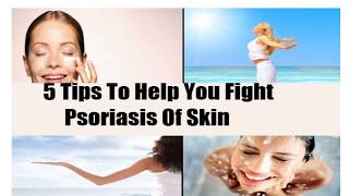 What is Psoriasis? Know Top 30 home remedies for psoriasis