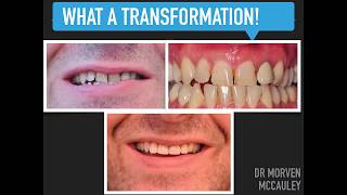 What A Transformation For Eric Following His Smile Makeover