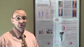 Vein Treatment Introduction Sclerotherapy Varicose veins ambulatory phlebectomy