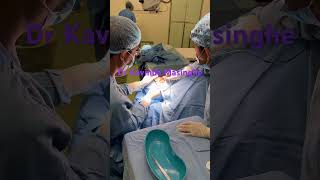 Blepharoplasty by Dr Kavinda Masinghe, eye surgeon