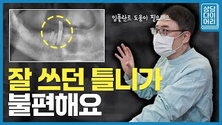 틀니와 임플란트 고민 중이라면? 이 영상 꼭 보세요