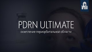 PDRN Ultimate в периорбитальной зоне: осветление с 1 вкола