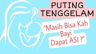 PUTTING TERBENAM | Masih Bisa Kah  Menyusui ?