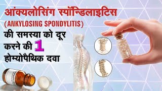 Earlier Ankylosing Spondylitis one remedy  || Single Homeopathic symptoms || hlab27 होम्योपैथिक दवा